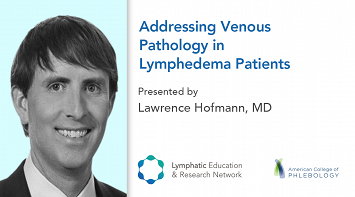 Addressing Venous Pathology in Lymphedema Patients thumbnail Photo